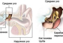 Строение полости среднего уха