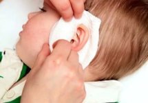 Как наложить согревающий компресс на ухо ребенку