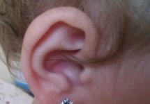 Какие бывают последствия прокола ушей у ребенка?